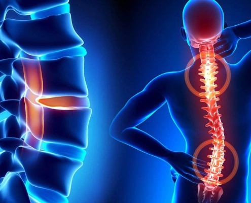 ژل ضد درد آرومیکس باریج 2
