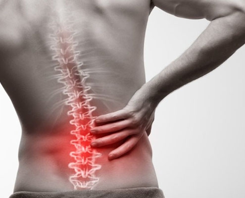 ژل ضد درد آرومیکس باریج 3